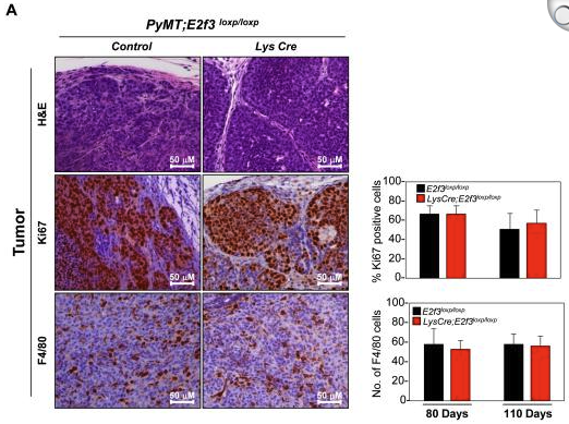 E2f3 in tumor macrophages promotes lung metastasis