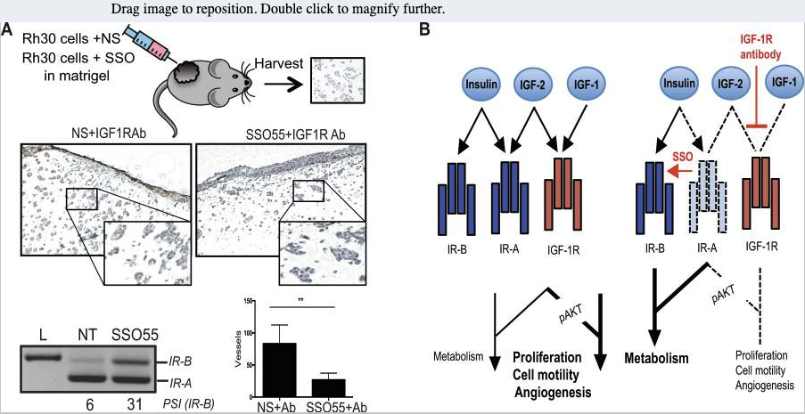 Splice-switching of the insulin receptor pre-mRNA alleviates tumorigenic hallmarks in rhabdomyosarcoma