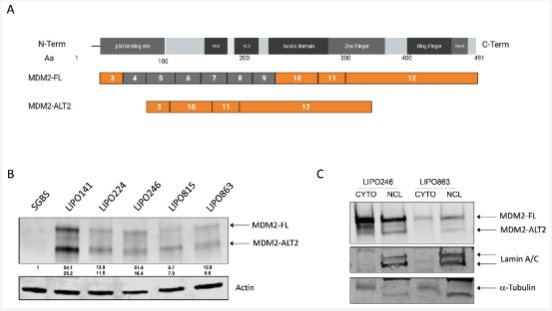 Oncogenic Functions of Alternatively Spliced MDM2-ALT2 Isoform in Retroperitoneal Liposarcoma